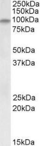 Anti-DAG1 Antibody (A82725) (0.2 µg/ml) staining of Human Skeletal Muscle lysate (35 µg protein in RIPA buffer). Primary incubation was 1 hour. Detected by chemiluminescence