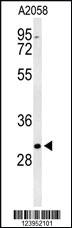 Anti-BASP1 Rabbit Polyclonal Antibody [clone: 432CT31.4.2]