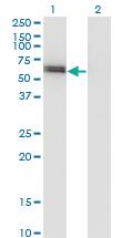 Anti-SPP1 Mouse Monoclonal Antibody [clone: 4D8]