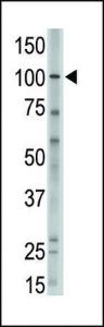 Anti-MVP Rabbit Polyclonal Antibody