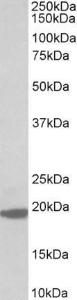 Anti-MCTS1 Antibody (A82726) (0.3 µg/ml) staining of MOLT4 lysate (35 µg protein in RIPA buffer). Primary incubation was 1 hour. Detected by chemilu minescence