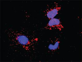 Anti-HSP90AB1 + NFKB1 Antibody Pair