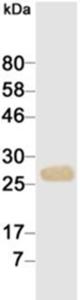 Western blotting result