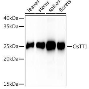 Western blot analysis of extracts of various tissues from the japonica rice (Oryza sativa L. ) variety Zhonghua 11, using Anti-polyclonal antibody1 Antibody (A309901) at 1:1,000 dilution. The secondary antibody was Goat Anti-Rabbit IgG H&L Antibody (HRP) at 1:10,000 dilution.