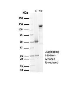 SDS-PAGE analysis of Anti-Decorin Antibody [DCN/7031R] under non-reduced and reduced conditions; showing intact IgG and intact heavy and light chains, respectively. SDS-PAGE analysis confirms the integrity and purity of the antibody