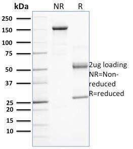 SDS-PAGE analysis of Anti-PD-L1 Antibody [PDL1/2743] under non-reduced and reduced conditions; showing intact IgG and intact heavy and light chains, respectively. SDS-PAGE analysis confirms the integrity and purity of the Antibody