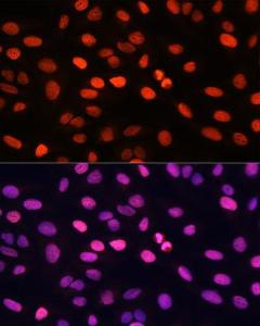 Immunofluorescence analysis of U2OS cells using Anti-Histone H3.1 Antibody (A308913) at a dilution of 1:100 (40x lens). DAPI was used to stain the cell nuclei (blue)