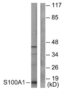 Western blot analysis of lysates from A549 cells using Anti-S100 A1 Antibody. The right hand lane represents a negative control, where the antibody is blocked by the immunising peptide