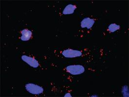 Anti-RPS6KA3 + MAPK1 Antibody Pair