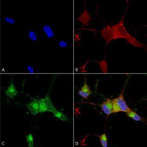 Immunocytochemistry/Immunofluorescence analysis of human neuroblastoma cells (SH-SY5Y), fixed in 4% PFA for 15 min, using Anti-Nav1.7 Antibody [N68/6] (A304801), at 1:100 for overnight at 4 °C with slow rocking