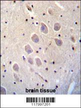 Anti-NGFR Rabbit Polyclonal Antibody (APC (Allophycocyanin))