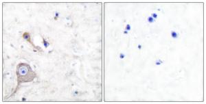 Immunohistochemical analysis of paraffin-embedded human brain tissue using Anti-S100 A1 Antibody. The right hand panel represents a negative control, where the antibody was pre-incubated with the immunising peptide