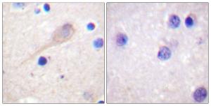 Immunohistochemical analysis of paraffin-embedded human brain tissue using Anti-Parkin Antibody. The right hand panel represents a negative control, where the antibody was pre-incubated with the immunising peptide.