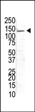 Anti-USP8 Rabbit Polyclonal Antibody