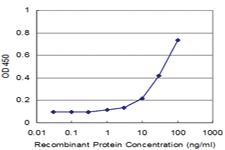 Anti-MAGEA1 Mouse Monoclonal Antibody [clone: 3H5]