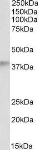 Anti-ADH5 Antibody (A84301) (0.5µg/ml) staining of Human Testis lysate (35µg protein in RIPA buffer). Primary incubation was 1 hour. Detected by chemiluminescence.