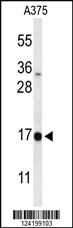 Anti-IHH Rabbit Polyclonal Antibody