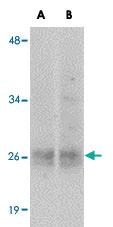 Anti-EPHA10 Rabbit Polyclonal Antibody