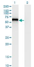 Anti-SPP1 Mouse Monoclonal Antibody [clone: 4C4]