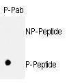 Anti-RB1 Rabbit Polyclonal Antibody (APC (Allophycocyanin))