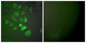 Immunofluorescence analysis of A549 cells using Anti-S100 A1 Antibody. The right hand panel represents a negative control, where the antibody was pre-incubated with the immunising peptide