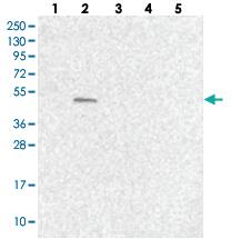 Anti-SUMF1 Rabbit Polyclonal Antibody