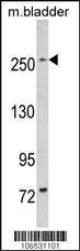 Anti-LRRK1 Rabbit Polyclonal Antibody (HRP (Horseradish Peroxidase))