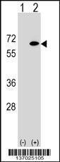 Anti-EYA2 Rabbit Polyclonal Antibody (HRP (Horseradish Peroxidase))