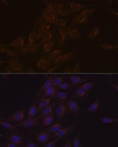 Immunofluorescence analysis of C6 cells using Anti-PIST Antibody [ARC1831] (A307711) at a dilution of 1:100 (40X lens). DAPI was used to stain the cell nuclei (blue)