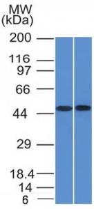 Western blot analysis of THP-1 and Raji Cell lysates using Anti-FLI1 Antibody [FLI1/1312]