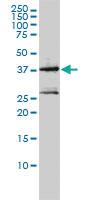 Anti-MAGEA2 Mouse Monoclonal Antibody [clone: 1H4]