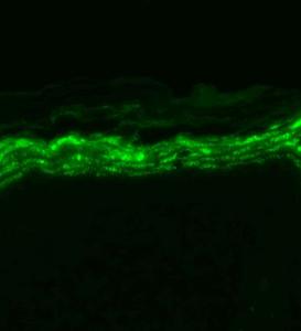 Immunohistochemistry analysis of mouse backskin, fixed in Bouin's fixative solution and paraffin-embedded