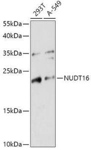 Western blot analysis of extracts of various cell lines, using Anti-NUDT16 Antibody (A305999) at 1:1,000 dilution. The secondary antibody was Goat Anti-Rabbit IgG H&L Antibody (HRP) at 1:10,000 dilution.