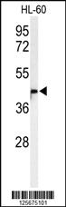 Anti-M11D1 Rabbit Polyclonal Antibody