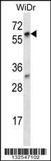 Anti-LARP7 Rabbit Polyclonal Antibody