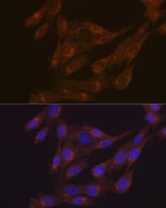 Immunofluorescence analysis of NIH-3T3 cells using Anti-PIST Antibody [ARC1831] (A307711) at a dilution of 1:100 (40X lens). DAPI was used to stain the cell nuclei (blue)