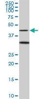 Anti-MAPK3 Mouse Monoclonal Antibody [clone: 1F7]