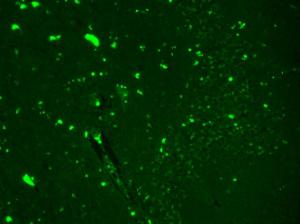 Immunohistochemistry analysis of human hippocampus, fixed in Bouin's fixative solution and paraffin-embedded