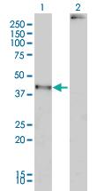 Anti-MAGEA2 Mouse Monoclonal Antibody [clone: 1H4]