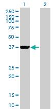 Anti-GIPC1 Mouse Polyclonal Antibody