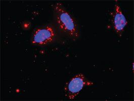 Anti-MAP3K7 + NLK Antibody Pair