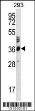 Anti-OR2T27 Rabbit Polyclonal Antibody (AP (Alkaline Phosphatase))