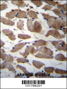 Anti-ACTN3 Rabbit Polyclonal Antibody (Biotin)