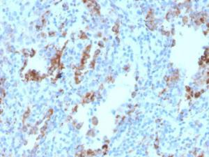 Immunohistochemical analysis of formalin-fixed, paraffin-embedded human lymph node using Anti-TIM3 Antibody [TIM3/4030]