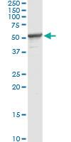 Anti-PPM1F Antibody Pair