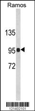 Anti-CR2 Rabbit Polyclonal Antibody