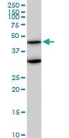 Anti-MAPK3 Mouse Monoclonal Antibody [clone: 1F7]