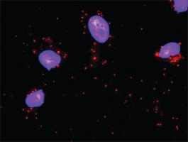 Anti-PIAS2 + PIAS1 Antibody Pair