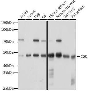 Western blot analysis of extracts of various cell lines, using Anti-CSK Antibody [ARC1835] (A307712) at 1:1,000 dilution. The secondary antibody was Goat Anti-Rabbit IgG H&L Antibody (HRP) at 1:10,000 dilution.