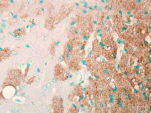 Immunohistochemistry analysis of mouse brain slice, fixed in frozen sections